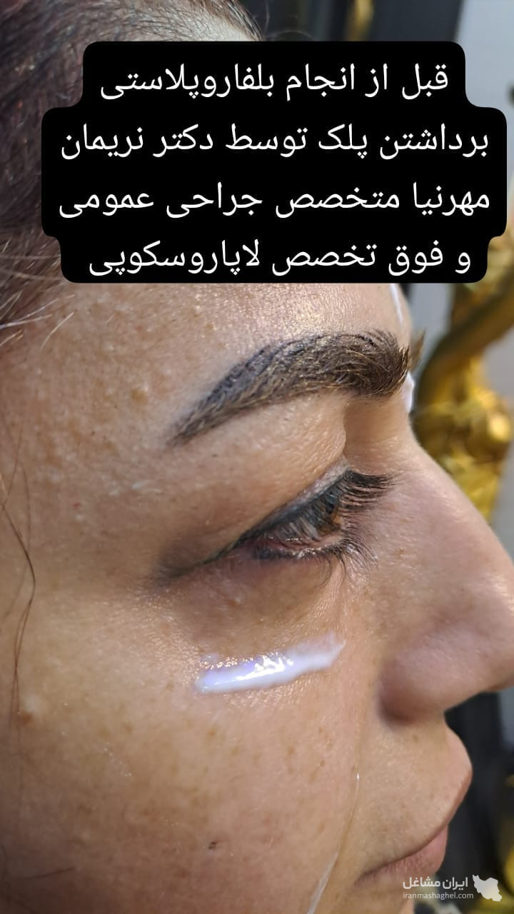 مطب تخصصی پوست و مو دکتر نریمان مهرنیا در تهرانپارس تهران